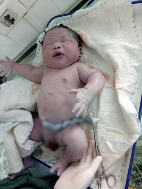 Bé trai sơ sinh 1,7 kg nặng nhất Việt Nam vừa chào đời tại bệnh viện tuyến huyện - Ảnh 2.