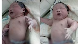 Bé trai sơ sinh 7,1kg nặng nhất Việt Nam vừa chào đời tại bệnh viện tuyến huyện