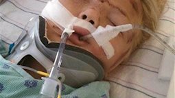 Bé gái 6 tuổi gặp tai nạn, suýt bị cắt đứt đôi người vì một thói lười nguy hiểm của bố mẹ