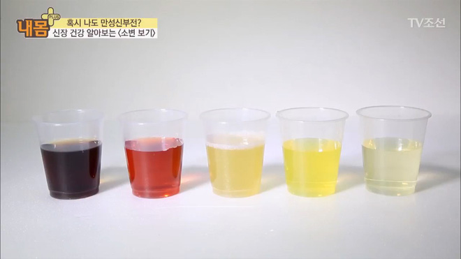 Bác sĩ Hàn Quốc hướng dẫn cách nhìn tình trạng nước tiểu xác định xem cơ thể đang mắc bệnh gì - Ảnh 1.