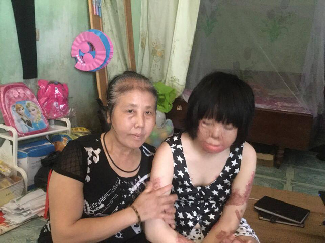  Nguyễn Thị Thùy Dung và mẹ đẻ. Ảnh: Ngọc Thi 