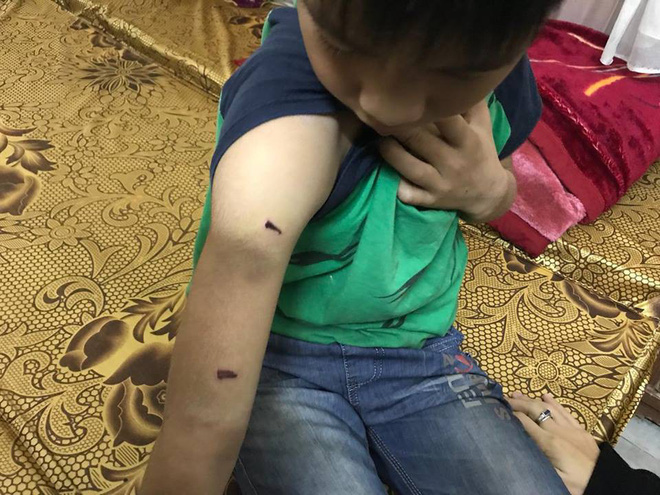 Hà Nội: Thêm một bé trai kể lại bị bố đánh dã man, dùng dây điện chít cổ - Ảnh 3.