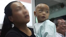 TP.HCM: Mẹ chủ quan không điều trị đầy đủ viêm xoang ở mũi cho con, bé trai 16 tháng tuổi suýt mù mắt phải