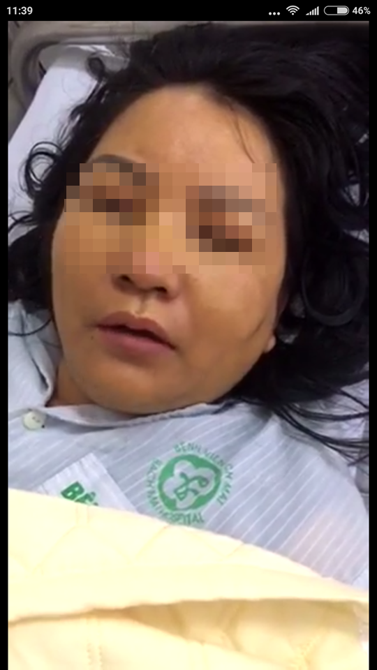 bệnh nhân TTN nhập viện Bạch Mai sau khi sử dụng thực phẩm giảm cân