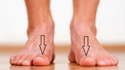 Một dấu hiệu ở ngón chân cái tiết lộ tình trạng "bất lực" ở nam giới