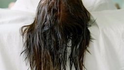 Cảnh báo: Cô gái bỗng dưng liệt nửa mặt, méo miệng vì để tóc ướt khi ngủ