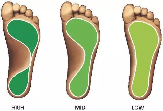 Nguyên nhân chẳng ngờ tới khiến bạn bị đau chân khi đi giày cao gót - Ảnh 9.