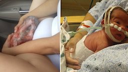 Đẻ rơi trên ô tô, người mẹ này không ngờ mình đẻ được ''con bọc điều'' 
