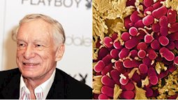 Cựu biên tập viên Playboy đã chết vì vi khuẩn kháng thuốc. Bạn còn dám dùng kháng sinh bừa bãi?