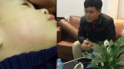 Hà Nội: Bác sĩ phòng khám tư thẳng tay tát bé 22 tháng tuổi vì "cơn nóng giận nhất thời"