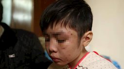 Vụ cháu bé nghi bị cha ruột và dì ghẻ bạo hành ở Hà Nội: Mẹ đẻ và người thân ở đâu?