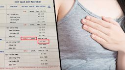 Không mang thai nhưng ngực tiết sữa non: Cẩn thận với bệnh u tuyến yên