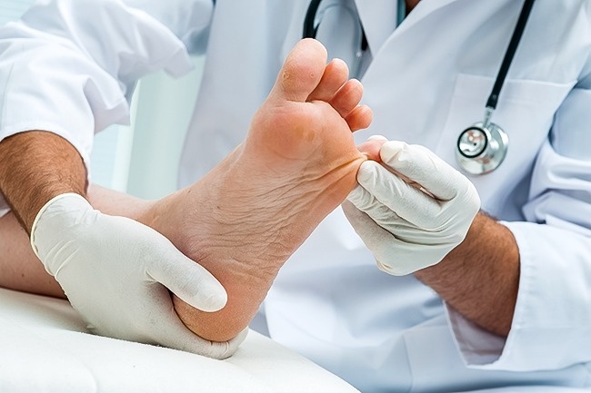 Những bệnh thường gặp ở chân trong mùa hè và cách xử lý đơn giản nhất - Ảnh 6.