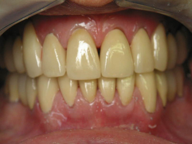 11 cách đơn giản ngay tại nhà giúp răng ố vàng trở nên sáng bóng  - Ảnh 1.