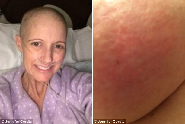 Chỉ bị phát ban trên da, bà mẹ 2 con sốc nặng khi được chẩn đoán mắc bệnh ung thư - Ảnh 1.