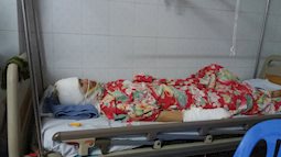 Người vợ bị chồng cũ tạt axit ở Hà Nội: "Con không muốn anh ấy đi tù, con tha thứ"