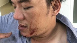 Khách tố bị nhân viên đuổi đánh dã man sau bữa ăn ở Đà Nẵng, quản lý nhà hàng nói gì?