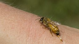 Đừng coi thường khi bị côn trùng đốt: Trang bị kỹ năng để xử lý đúng cách, tránh biến chứng đe dọa tính mạng
