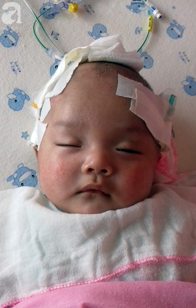 Tiếng khóc xé lòng của bé trai hơn 5 tháng tuổi mắc bệnh não úng thủy - Ảnh 1.
