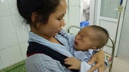 Bé 7 tháng tuổi bị hỏng 1 bên mắt vĩnh viễn vì mẹ nhỏ sữa chữa đỏ mắt