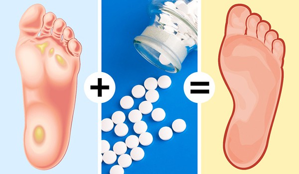 Nghiền nhuyễn 4 viên aspirin, trộn thêm chút nước chanh rồi hoà vào chậu nước ấm, ngâm chân khoảng 20 phút rồi chà nhẹ để lấy đi vết chai chân.