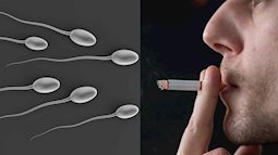 Hút thuốc làm giảm khả năng sinh sản và rối loạn tình dục ở nam giới