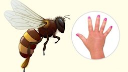 Cách nhận biết vết côn trùng cắn