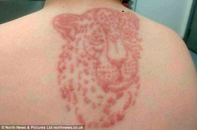 Hai đứa trẻ đau đớn khi tay, lưng sưng tấy do vẽ henna trong chuyến du lịch và lời cảnh báo nhiều phụ huynh bỏ qua - Ảnh 2.