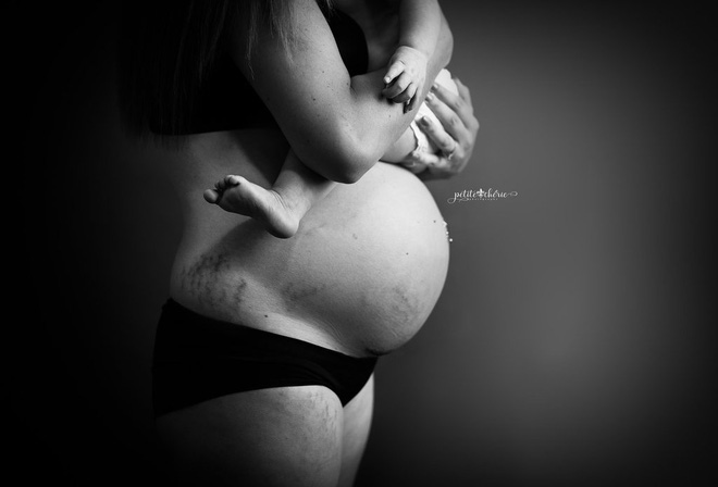 Những bức ảnh này cho thấy cơ thể người mẹ đã bị tàn phá khủng khiếp thế nào sau khi sinh - Ảnh 2.