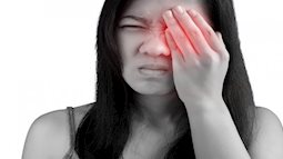 Bỏng rát mắt vào mùa hè là dấu hiệu của bệnh gì?