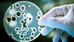 Xuất hiện bệnh nhân kháng tất cả các loại kháng sinh, bác sĩ cảnh báo 'cuộc chiến' của siêu vi khuẩn với loài người