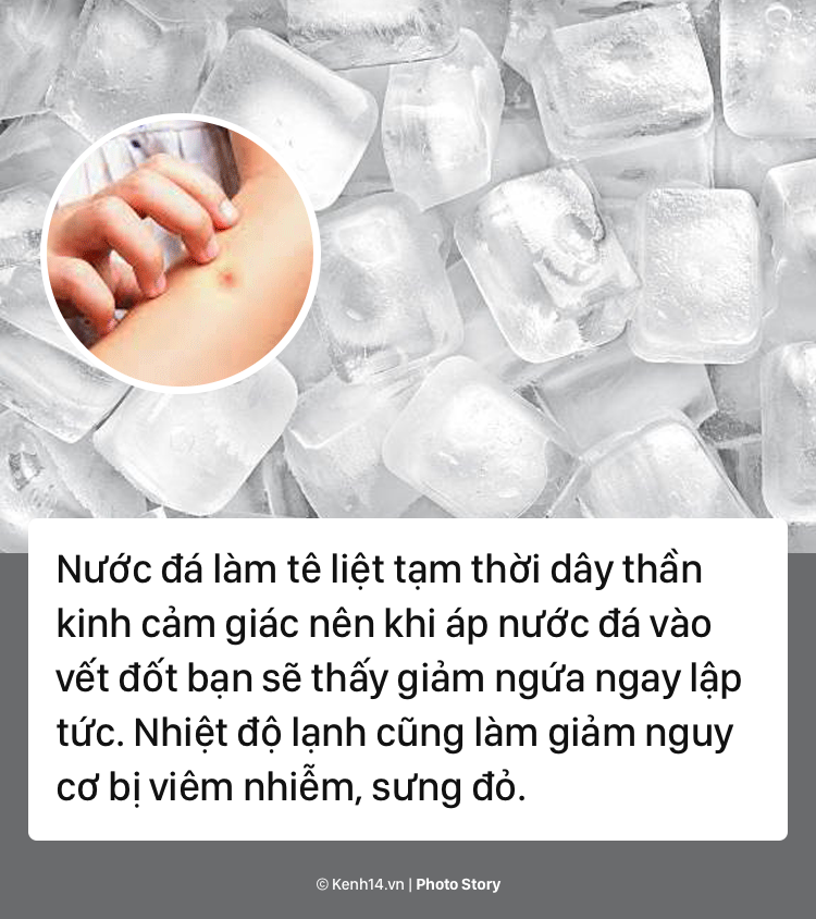 Giải quyết ngay vết muỗi đốt với các sản phẩm tự nhiên này - Ảnh 9.