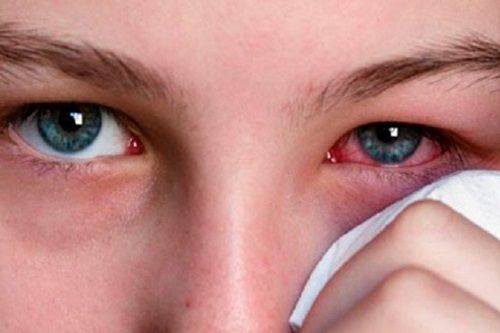 Theo các chuyên gia nhãn khoa, cần vệ sinh mắt hàng ngày bằng nước muối sinh lý nhằm bảo vệ mắt, rửa trôi bụi bẩn… giúp làm ẩm mắt, chống khô mắt. Ảnh: TL