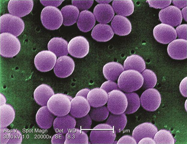 Tụ cầu khuẩn Staphylococcus aureus.