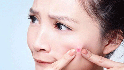 Nắm rõ những nguyên tắc cơ bản này, mụn bọc cứng đầu đến đâu cũng bay nhanh chỉ trong 'một nốt nhạc'