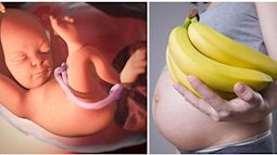 Mẹ bầu ăn 1 quả chuối vào thời điểm VÀNG này nhận về công dụng tuyệt vời, dinh dưỡng hấp thụ hết vào con