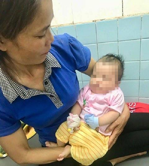 Bé hai tháng tuổi ở Nghệ An bị chó cắn khi đang nằm ngủ trên võng. Ảnh: L.N