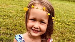 Cô bé 4 tuổi suýt mất mạng vì bị chó dữ cắn