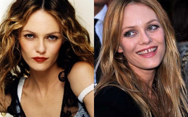 Tình cũ của Johnny Depp - ca sĩ Vanessa Paradis - gây dấu ấn riêng với “nụ cười răng thưa” của mình.