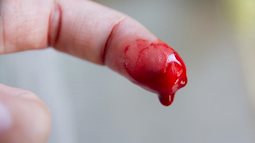 Tại sao giấy cắt vào tay lại đau hơn cả dao cứa?