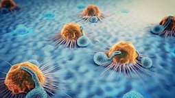 Hi vọng lớn: loại thuốc có thể làm teo tế bào ung thư