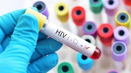  Đã tìm được cách tiêu diệt tế bào bị nhiễm HIV