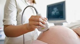 Thực hư chuyện siêu âm nhiều sẽ ảnh hưởng đến thai nhi?