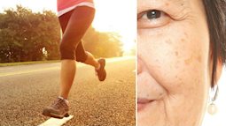 5 lý do bất ngờ khiến da mặt bạn chảy xệ sớm, trong đó có chạy bộ