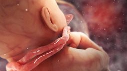Những điều mẹ bầu tuyệt đối không nên làm khi thai nhi bị dây rốn quấn cổ 