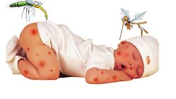Chăm con đúng cách khi dịch sốt xuất huyết vào mùa