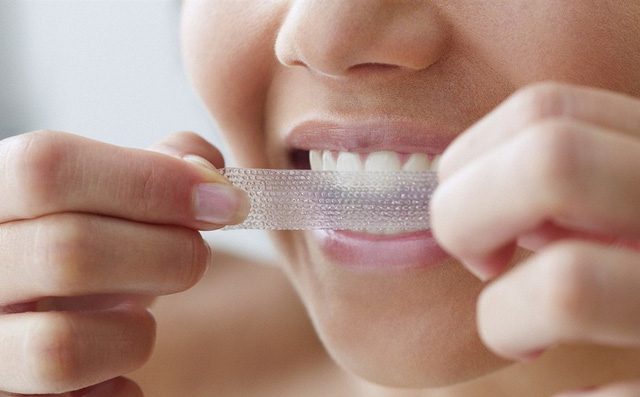 Các nhà khoa học cảnh báo: Làm trắng răng kiểu này có thể gây hại cho răng - Ảnh 1