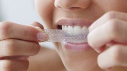 Các nhà khoa học cảnh báo: Làm trắng răng kiểu này có thể gây hại cho răng