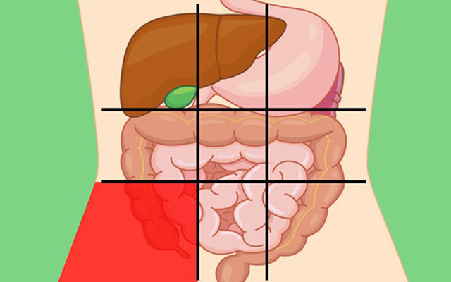  GS tiêu hoá chia sẻ: 7 vị trí đau bụng ai cũng cần biết để nhận diện mối nguy hiểm - Ảnh 3.