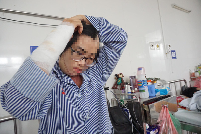 1 năm sau khi bị chồng cũ tạt axit, cô giáo Hà Nội xinh đẹp kể về 5 ngày chết lâm sàng, 21 lần ghép da - Ảnh 1.